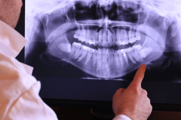 Best Emergency Treatment for Jaw Pain or Injury in Bude, MS